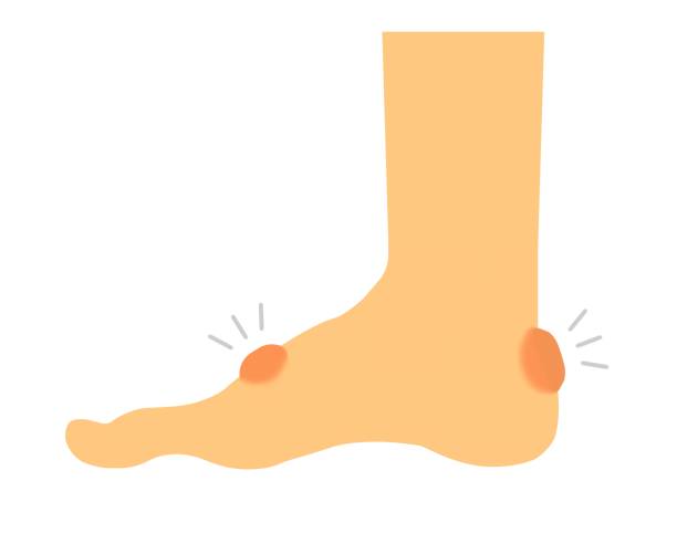 Blisters and Beyond: Understanding, Preventing, and Treating Foot Blisters in Hiking and Outdoor Activities